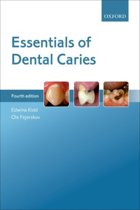 9780198738268-Essentials-of-Dental-Caries