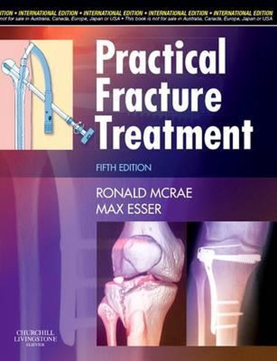 9780443068775 Practical Fracture Treatment International Edition