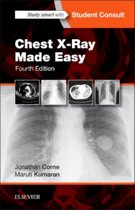 9780702054990-Chest-X-Ray-Made-Easy