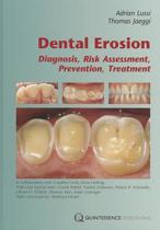 9781850972181 Dental Erosion