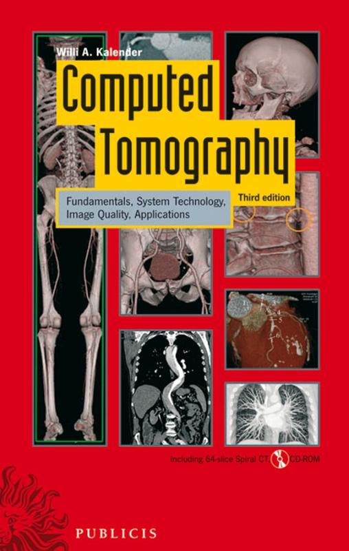9783895783173-Computed-Tomography