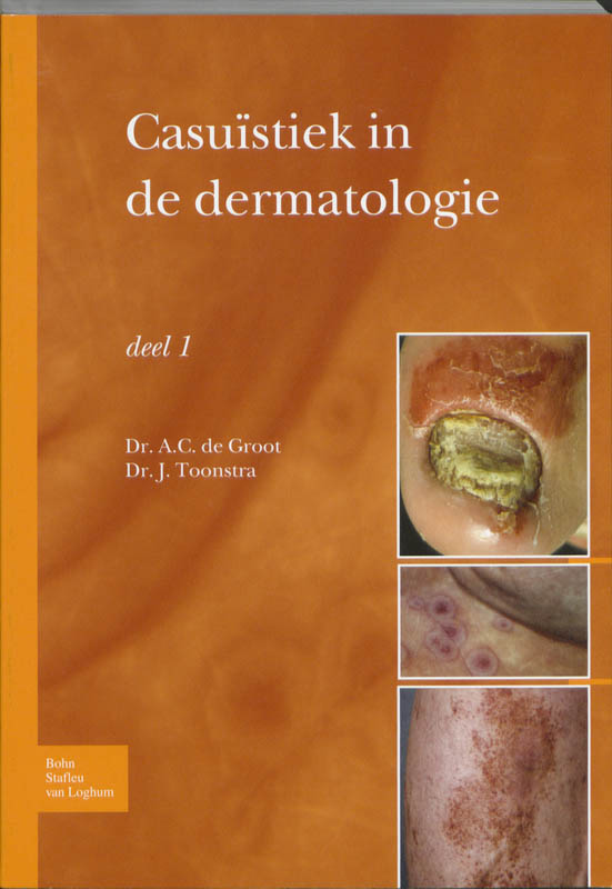 9789031361885-Casuistiek-in-de-dermatologie-deel-1