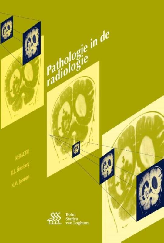 9789036816618-Pathologie-in-de-radiologie