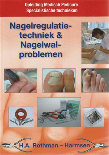 Nagelregulatietechniek en nagelwalproblemen
