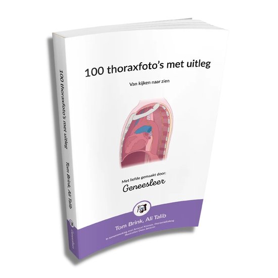 9789083223209 100 thoraxfotos met uitleg Van kijken naar zien