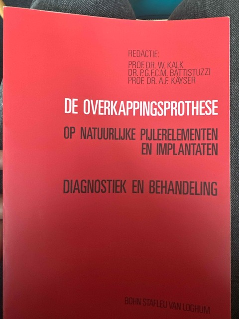 9789031311521-De-overkappingsprothese-op-natuurlijke-pijlerelementen-en-implantaten