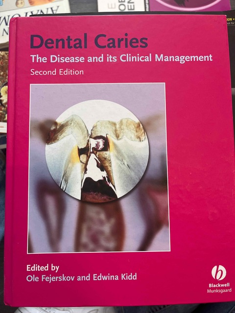 9781405138895-Dental-Caries