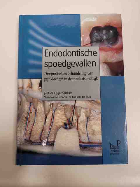 9789085620631-Endodontische-spoedgevallen